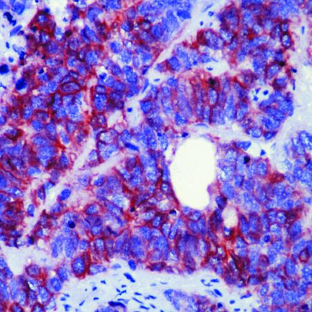 CD56 Antibody in Immunohistochemistry (Paraffin) (IHC (P))