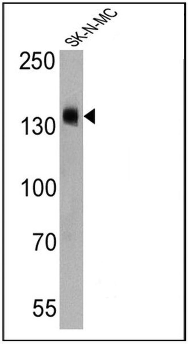 CD56 Antibody in Western Blot (WB)