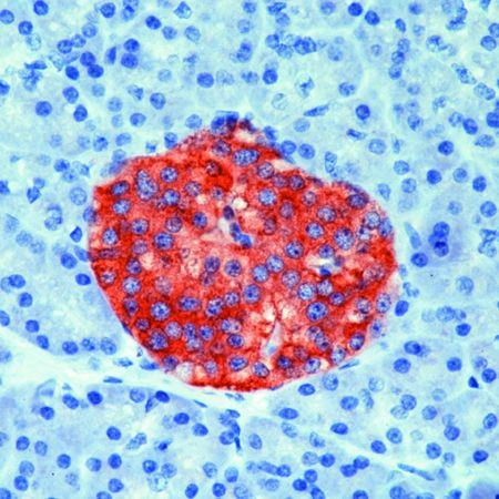 Synaptophysin Antibody in Immunohistochemistry (Paraffin) (IHC (P))