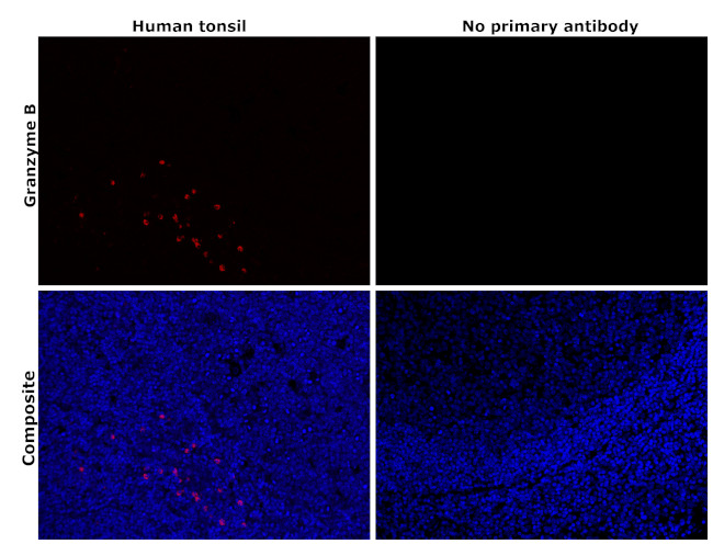 Granzyme B Antibody in Immunohistochemistry (Paraffin) (IHC (P))