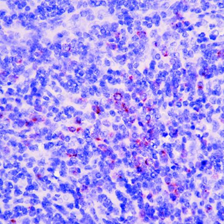 Granzyme B Antibody in Immunohistochemistry (Paraffin) (IHC (P))