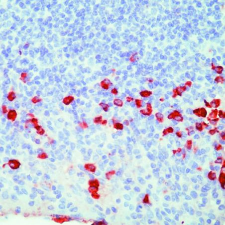 Human Lambda Light Chain Secondary Antibody in Immunohistochemistry (Paraffin) (IHC (P))