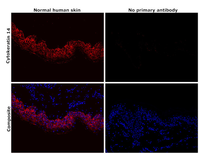 Cytokeratin 14 Antibody in Immunohistochemistry (Paraffin) (IHC (P))