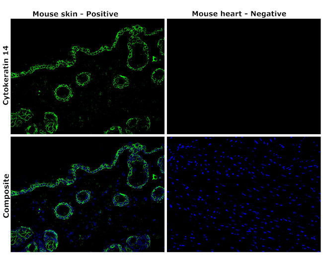 Cytokeratin 14 Antibody in Immunohistochemistry (Paraffin) (IHC (P))