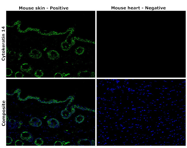 Cytokeratin 14 Antibody in Immunohistochemistry (Paraffin) (IHC (P))