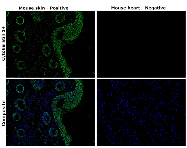 Cytokeratin 14 Antibody in Immunohistochemistry (Paraffin) (IHC (P))