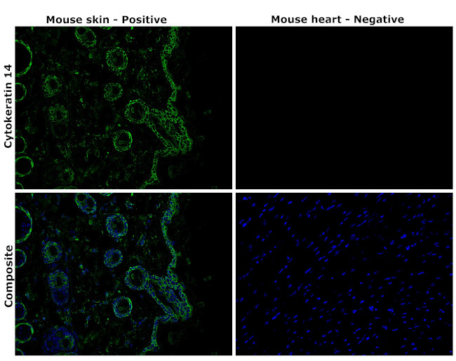 Cytokeratin 14 Antibody in Immunohistochemistry (Paraffin) (IHC (P))