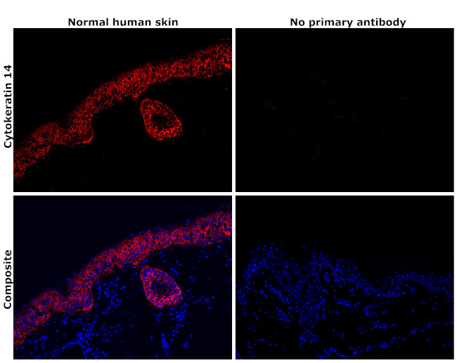 Cytokeratin 14 Antibody in Immunohistochemistry (Paraffin) (IHC (P))