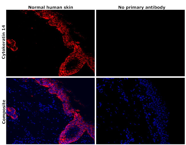 Cytokeratin 14 Antibody in Immunohistochemistry (Paraffin) (IHC (P))