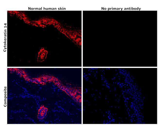 Cytokeratin 14 Antibody in Immunohistochemistry (Paraffin) (IHC (P))