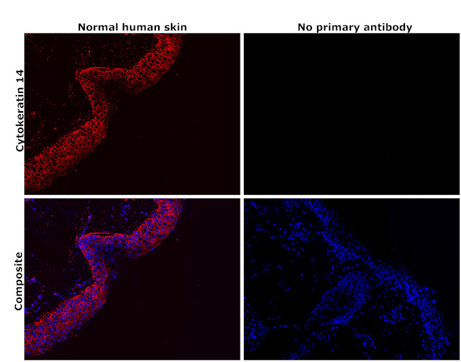 Cytokeratin 14 Antibody in Immunohistochemistry (Paraffin) (IHC (P))