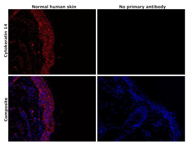 Cytokeratin 14 Antibody in Immunohistochemistry (Paraffin) (IHC (P))