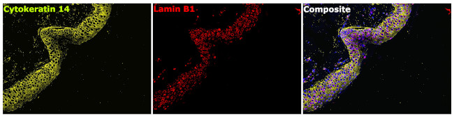 Cytokeratin 14 Antibody in Immunohistochemistry (Paraffin) (IHC (P))