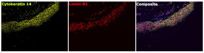 Cytokeratin 14 Antibody in Immunohistochemistry (Paraffin) (IHC (P))