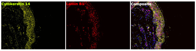 Cytokeratin 14 Antibody in Immunohistochemistry (Paraffin) (IHC (P))