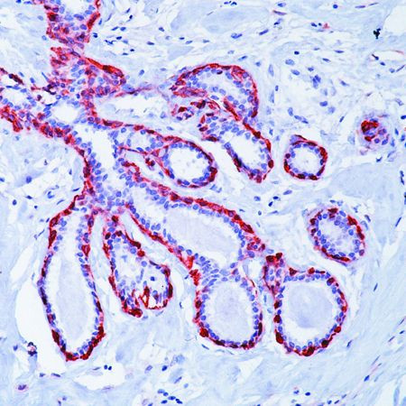 Calponin 1 Antibody in Immunohistochemistry (Paraffin) (IHC (P))