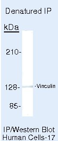 Vinculin Antibody in Immunoprecipitation (IP)