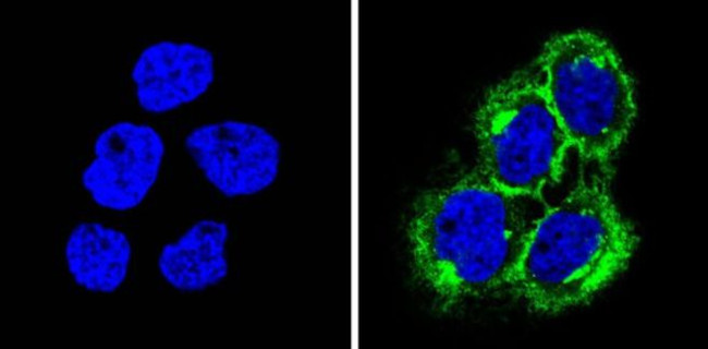 HLA-ABC Antibody in Immunocytochemistry (ICC/IF)