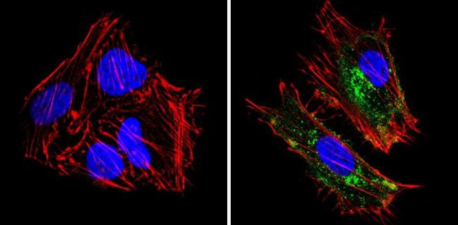 HLA-ABC Antibody in Immunocytochemistry (ICC/IF)