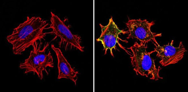 HLA-ABC Antibody in Immunocytochemistry (ICC/IF)