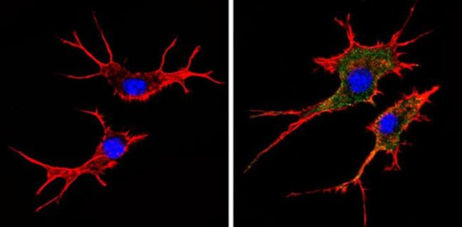 HLA-ABC Antibody in Immunocytochemistry (ICC/IF)