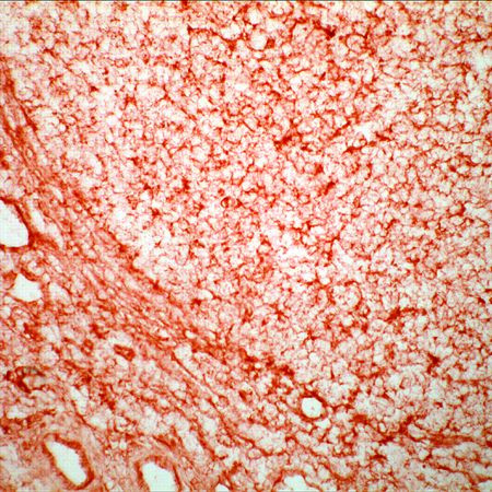 HLA-ABC Antibody in Immunohistochemistry (Frozen) (IHC (F))