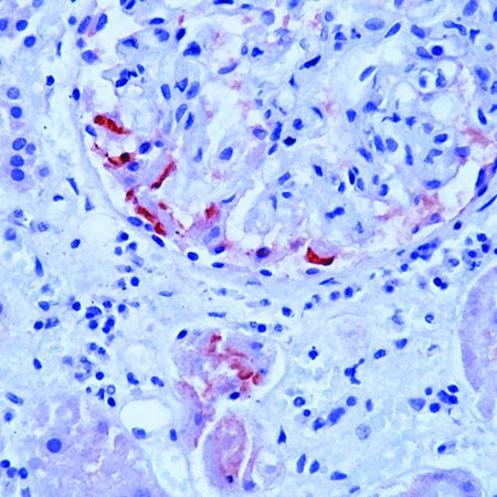 SAA Antibody in Immunohistochemistry (Paraffin) (IHC (P))