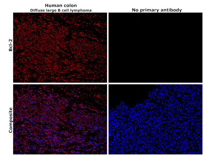 Bcl-2 Antibody in Immunohistochemistry (Paraffin) (IHC (P))