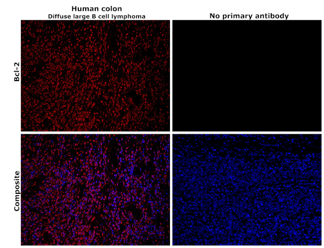 Bcl-2 Antibody in Immunohistochemistry (Paraffin) (IHC (P))