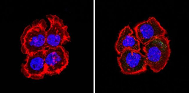 Bcl-2 Antibody in Immunocytochemistry (ICC/IF)