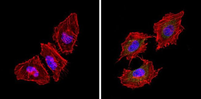 Bcl-2 Antibody in Immunocytochemistry (ICC/IF)