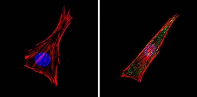 Bcl-2 Antibody in Immunocytochemistry (ICC/IF)