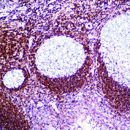 Bcl-2 Antibody in Immunohistochemistry (Paraffin) (IHC (P))