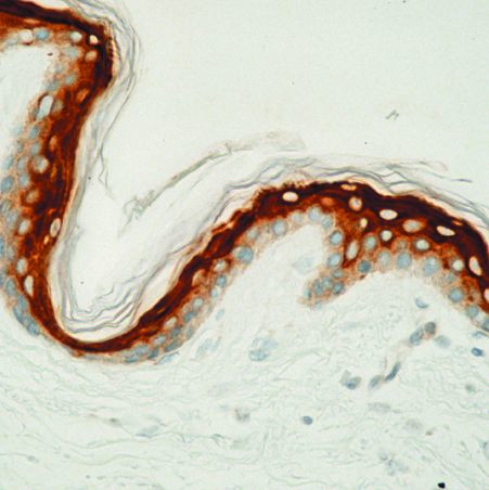 Involucrin Antibody in Immunohistochemistry (Paraffin) (IHC (P))