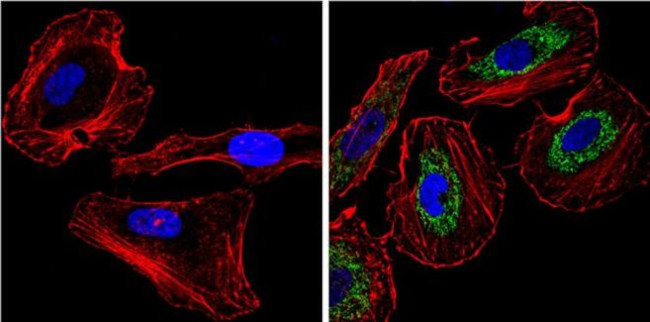 Cytochrome C Antibody in Immunocytochemistry (ICC/IF)