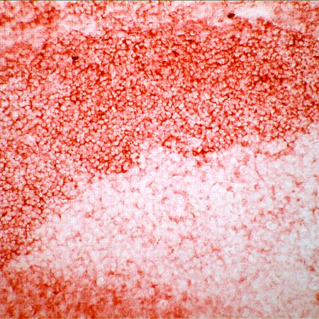 CD24 Antibody in Immunohistochemistry (Frozen) (IHC (F))