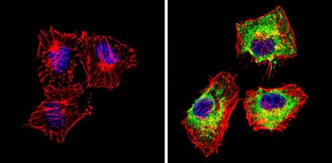 Actin Antibody in Immunocytochemistry (ICC/IF)