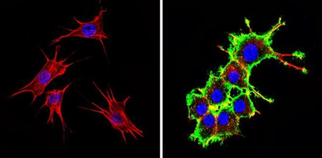 Actin Antibody in Immunocytochemistry (ICC/IF)