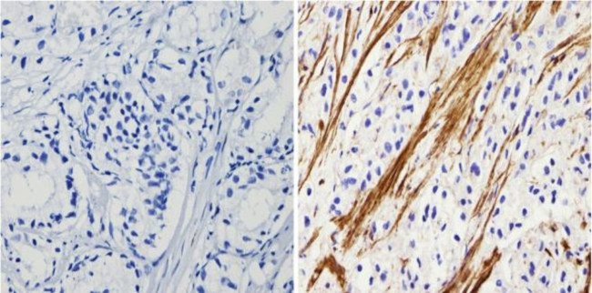 Actin Antibody in Immunohistochemistry (Paraffin) (IHC (P))