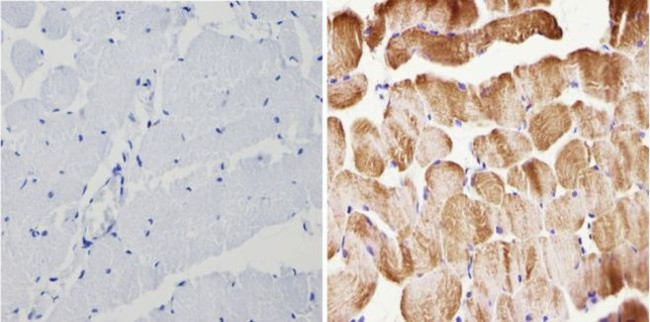 Actin Antibody in Immunohistochemistry (Paraffin) (IHC (P))