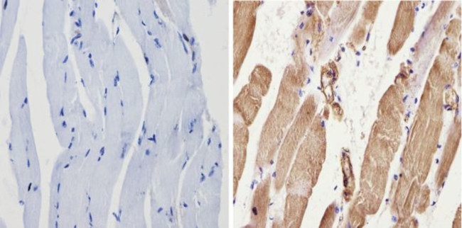 Actin Antibody in Immunohistochemistry (Paraffin) (IHC (P))