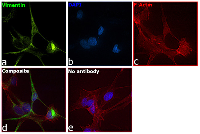 Vimentin Antibody in Immunocytochemistry (ICC/IF)