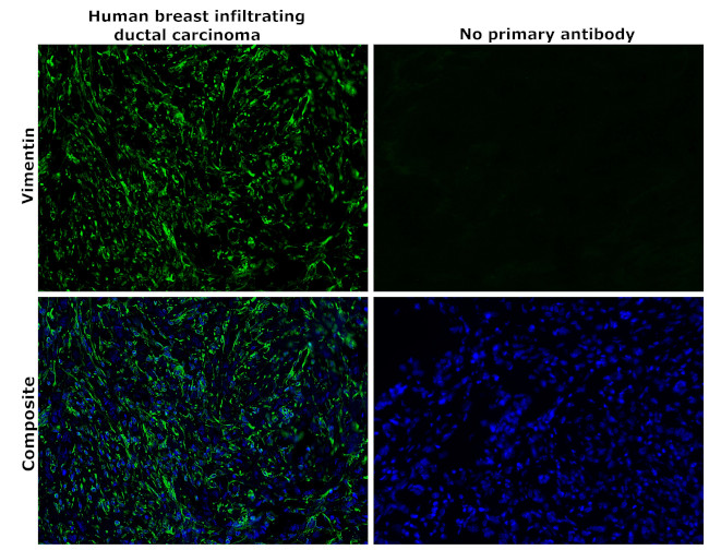 Vimentin Antibody in Immunohistochemistry (Paraffin) (IHC (P))