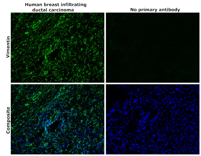 Vimentin Antibody in Immunohistochemistry (Paraffin) (IHC (P))