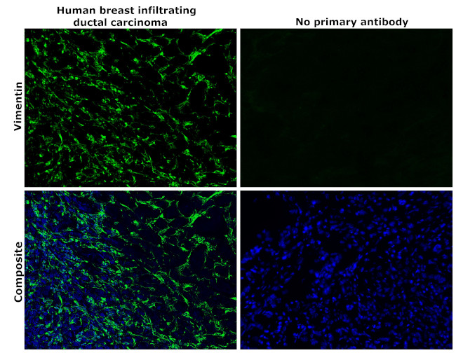 Vimentin Antibody in Immunohistochemistry (Paraffin) (IHC (P))