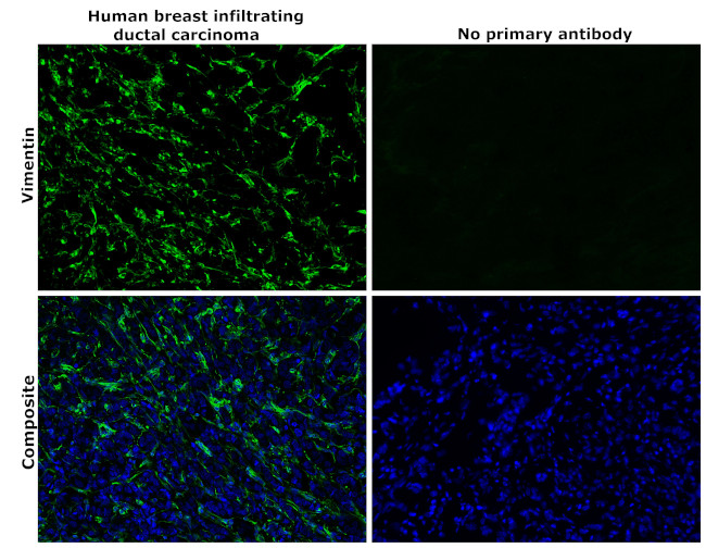 Vimentin Antibody in Immunohistochemistry (Paraffin) (IHC (P))