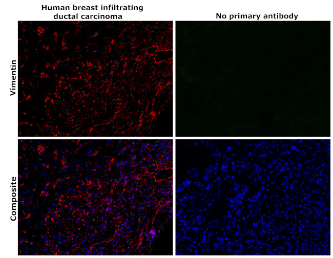 Vimentin Antibody in Immunohistochemistry (Paraffin) (IHC (P))