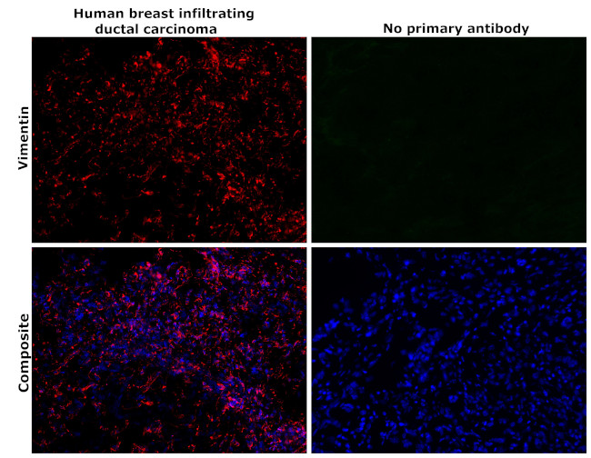 Vimentin Antibody in Immunohistochemistry (Paraffin) (IHC (P))