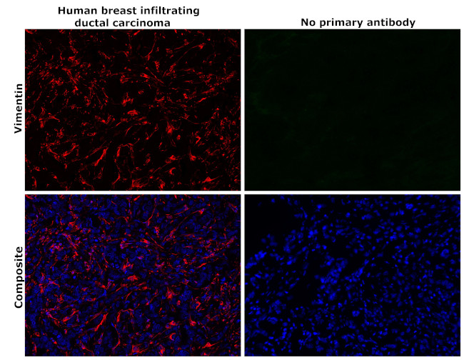 Vimentin Antibody in Immunohistochemistry (Paraffin) (IHC (P))