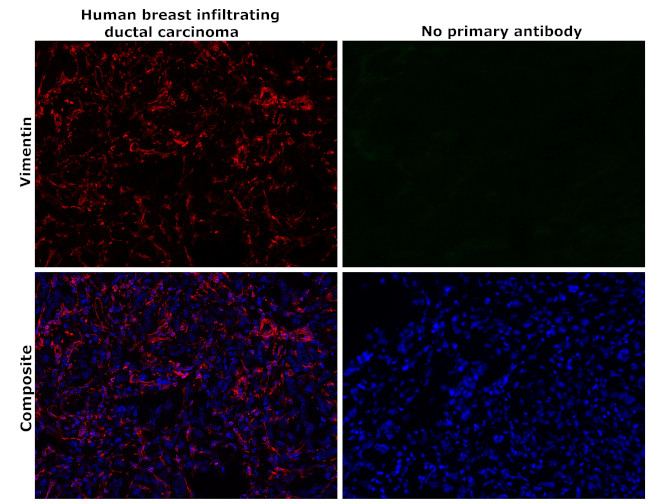 Vimentin Antibody in Immunohistochemistry (Paraffin) (IHC (P))